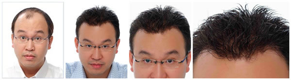 ���l(f��)�a(b��)�l(f��) ���l(f��)�ɹ�������ʿ