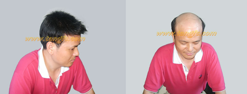 ��ʿ�ٰl(f��)