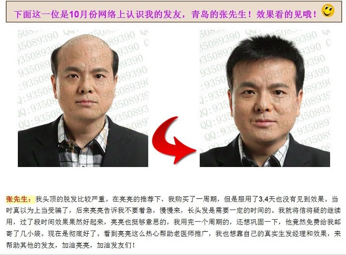 唐利民假發(fā)被生發(fā)公司冒充青島的張先生 唐利民假發(fā)被生發(fā)公司冒充青島的張先生