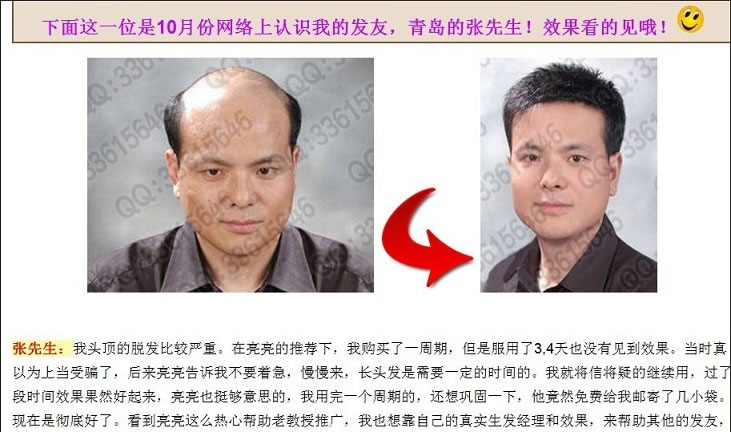 唐利民假發(fā)被生發(fā)公司冒充青島的張先生 唐利民假發(fā)被生發(fā)公司冒充青島的張先生