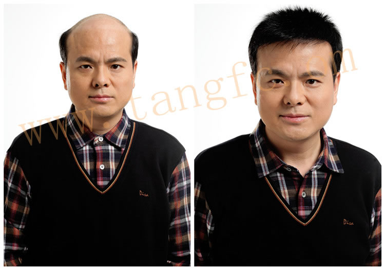 選擇男士假發(fā)需要注意什么?