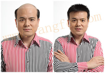 織發(fā)都有哪些優(yōu)勢 表現(xiàn)在哪些方面？