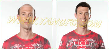 請問織發(fā)跟假發(fā)有什么區(qū)別么？