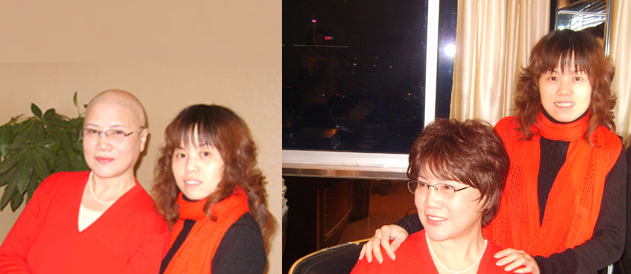 女性頭發(fā)稀疏謝頂怎么辦？如果發(fā)體稀疏就要避免這些！