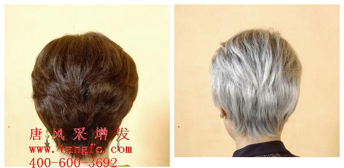 有了白發(fā)怎么辦？怎么讓白發(fā)變黑發(fā)？