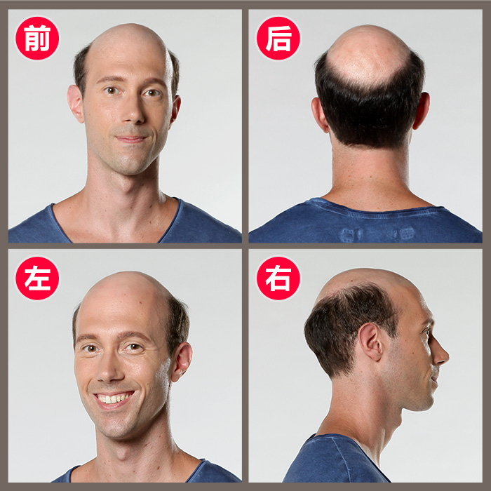 一個(gè)補(bǔ)發(fā)假發(fā)能使用多長(zhǎng)時(shí)間，你了解這些嗎？