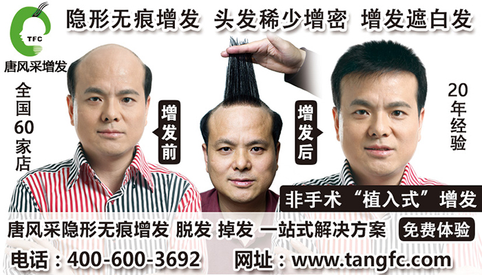 補(bǔ)發(fā)會掉嗎？2015男士補(bǔ)發(fā)價格怎么計(jì)算