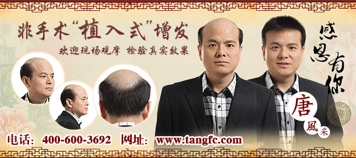 2015織發(fā)哪個(gè)牌子好？