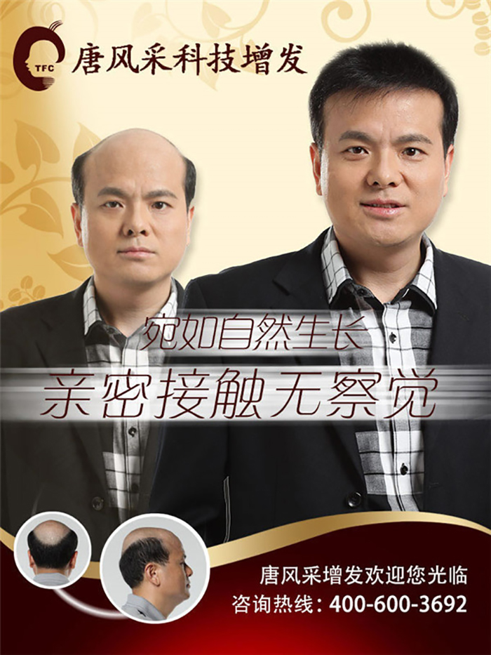 真頭發(fā)假發(fā)為什么這么受歡迎？