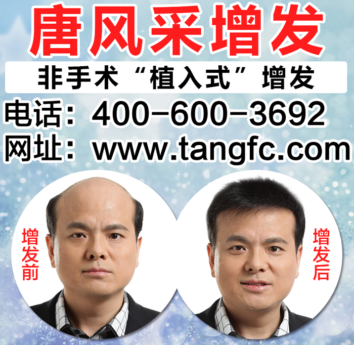 沈陽(yáng)哪里有織發(fā)？有需求的往哪里找呢？