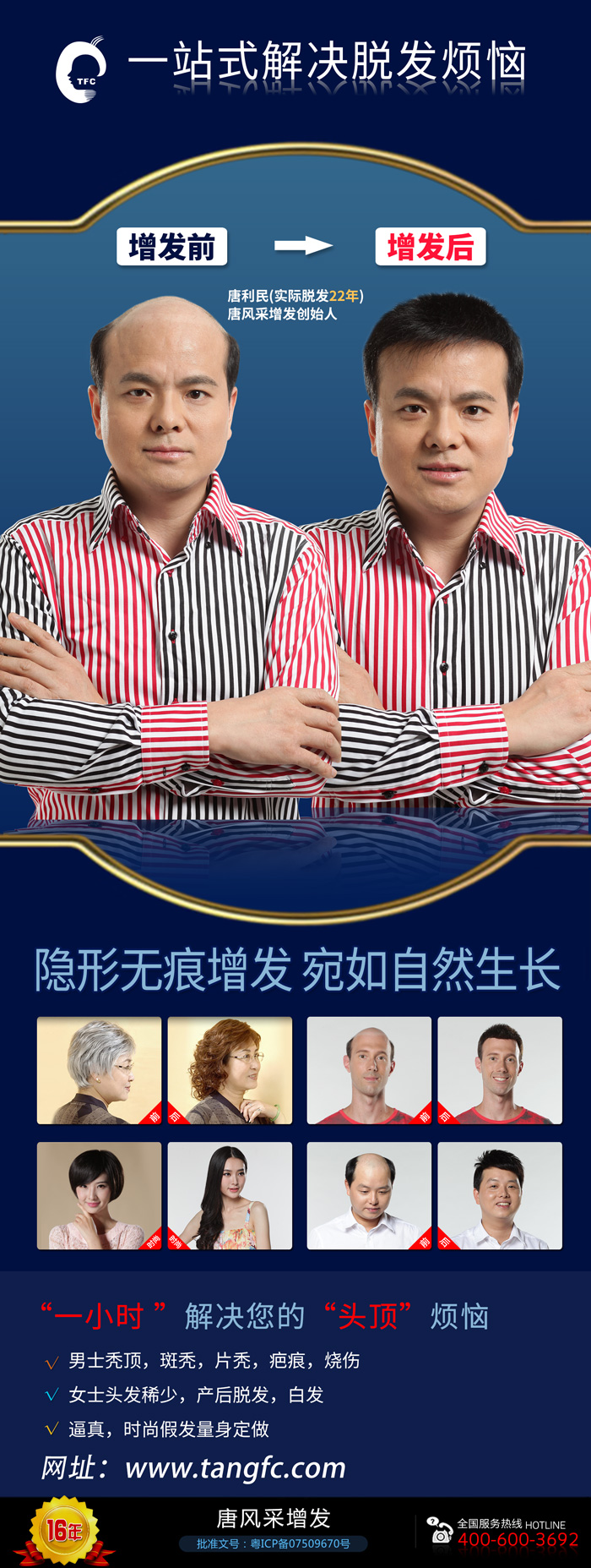 無痕補(bǔ)發(fā)價格是多少？哪里補(bǔ)發(fā)技術(shù)比較好？