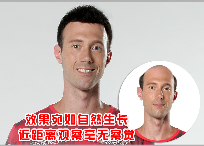 假發(fā)套真發(fā) 頭發(fā)稀少怎么辦 假發(fā)套真發(fā)怎能錯過