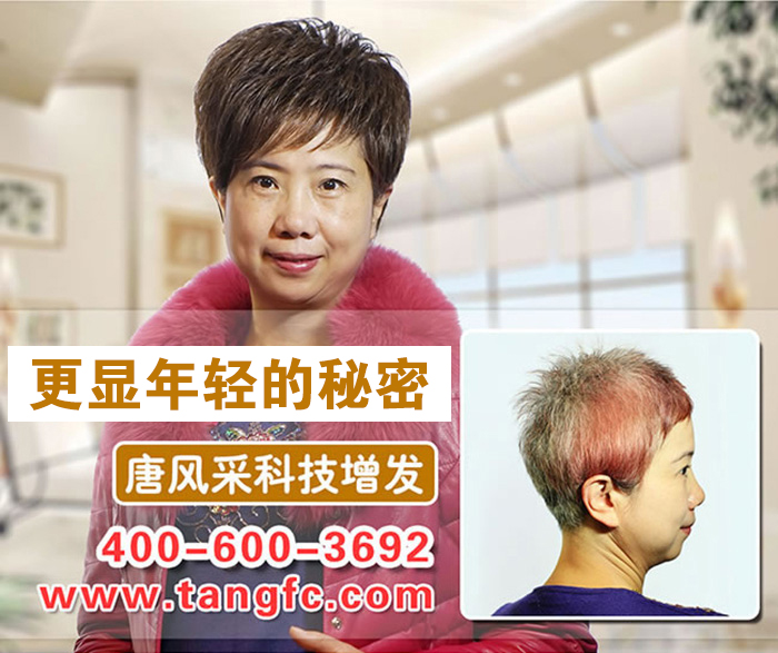 南寧最好的織發(fā)店在哪？脫發(fā)用織發(fā)可以救嗎？