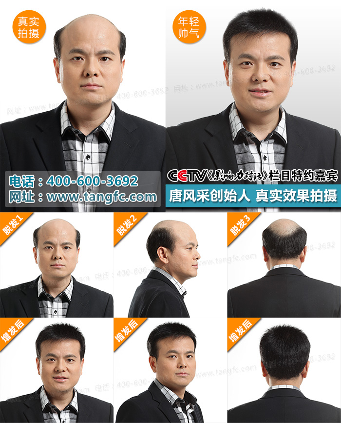 根據(jù)男士假發(fā)對(duì)比效果，哪個(gè)品牌假發(fā)值得信賴