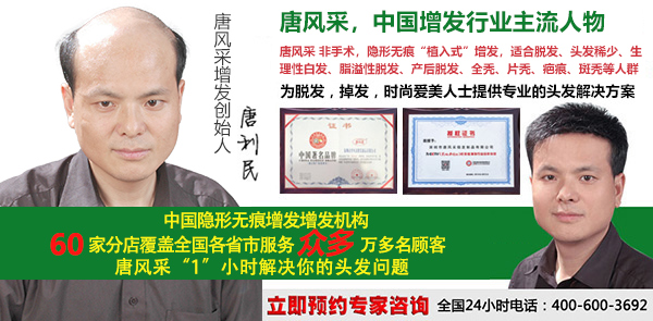 年輕人禿頂怎么辦？唐風(fēng)采效果告訴你答案！