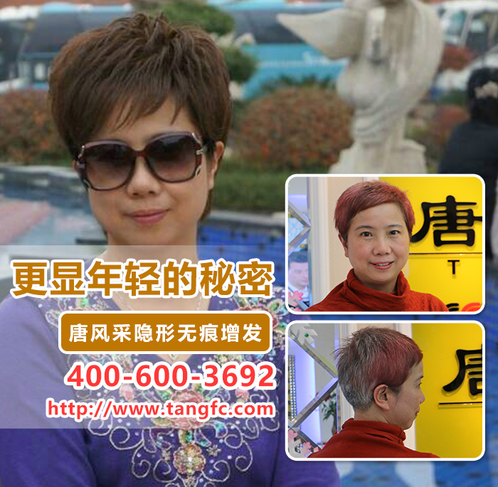 頭發(fā)稀少怎么補發(fā)？2016補發(fā)新型技術(shù)！