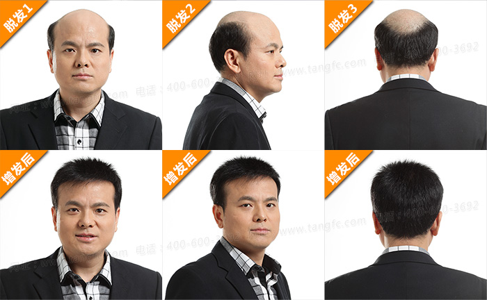 佛山織發(fā)哪里效果最好？它有什么特點(diǎn)？