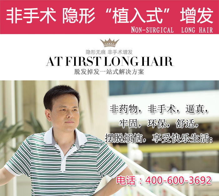 廈門哪里有量身定做假發(fā)的機(jī)構(gòu)？定制假發(fā)的優(yōu)勢(shì)