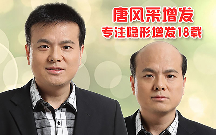 哪種男士發(fā)型好看？掉頭發(fā)怎么辦