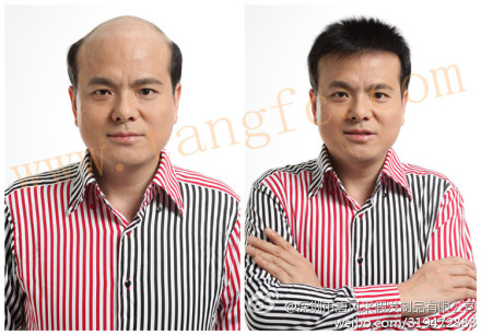 如何選擇男士假發(fā)專賣店？這類人易得雄脫