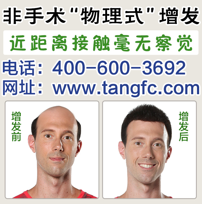 游戲男別為頭發(fā)困擾，唐風(fēng)采上海補(bǔ)發(fā)機(jī)構(gòu)為您解決問題！