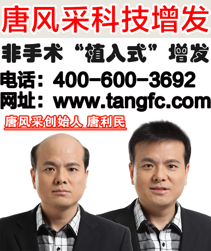 真人發(fā)中年男士假發(fā)多少錢(qián)？中年人為何易禿