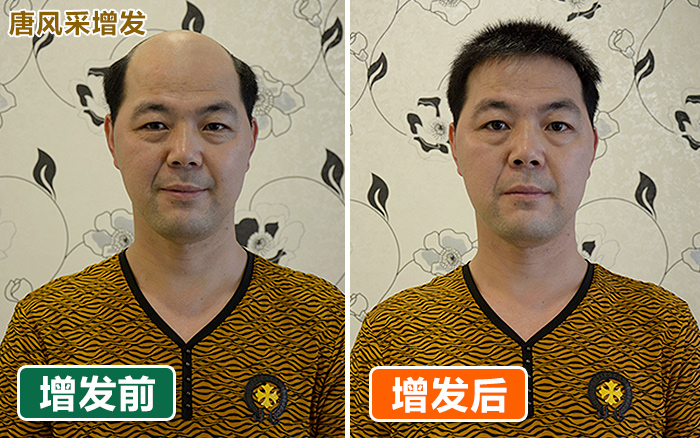 織發(fā)哪里效果最好？當(dāng)然是選擇中國的知名品牌