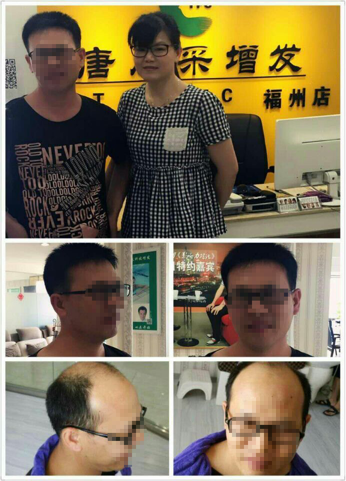 脫發(fā)后“藍(lán)瘦、香菇”，那你還在等什么？