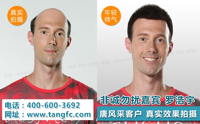 明星很逼真的假發(fā)，渾然天成的感覺是怎么做到的？