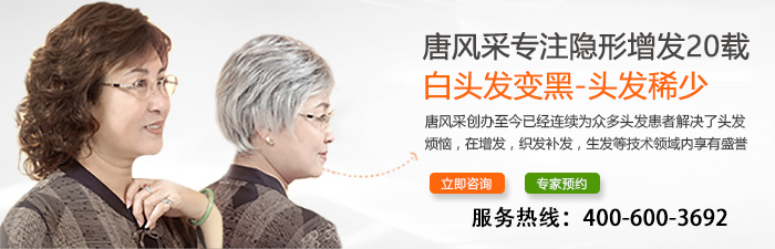 白發(fā)女士請注意，長期染發(fā)不可取，愛美就選織發(fā)補發(fā)