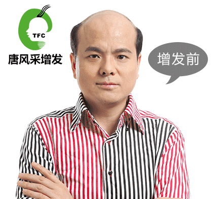 脫發(fā)頻繁 脫發(fā)頻繁容易抑郁 白領(lǐng)過勞現(xiàn)象叢生