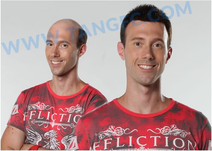 嘉興織發(fā)補發(fā)中心，唐風采專業(yè)補發(fā)塑造完美形象