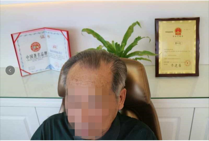 “大爺”秒變“萌叔”？唐風采假發(fā)為您保守年齡的秘密！