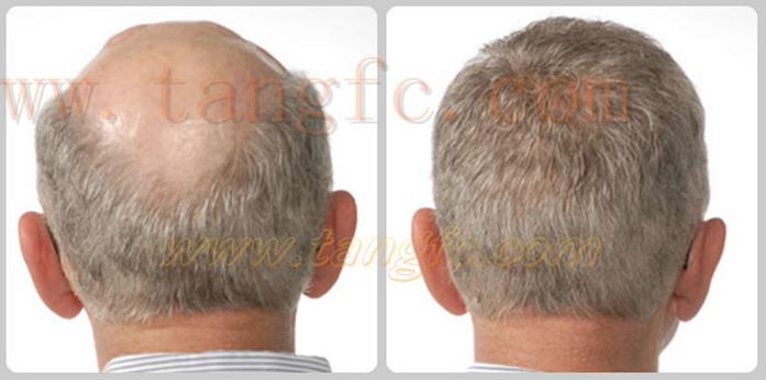 白發(fā)在金華補發(fā)機構(gòu)這里，這都不是事！