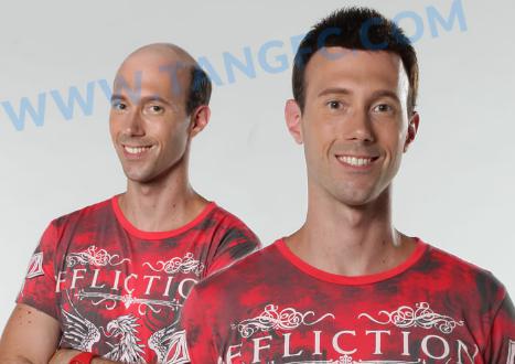 肌肉男多光頭？警惕激素脫發(fā)問(wèn)題！