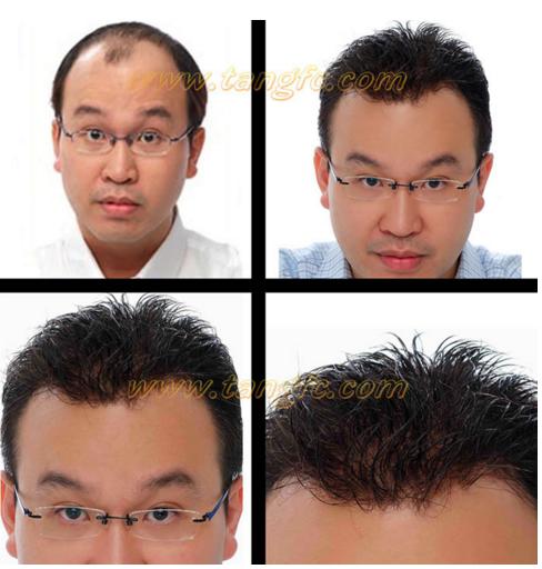 警惕電子產(chǎn)品輻射，走出護(hù)法誤區(qū)！