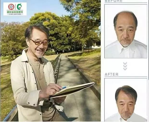 來自NASA的黑科技生發(fā)頭盔，禿頂有救了？