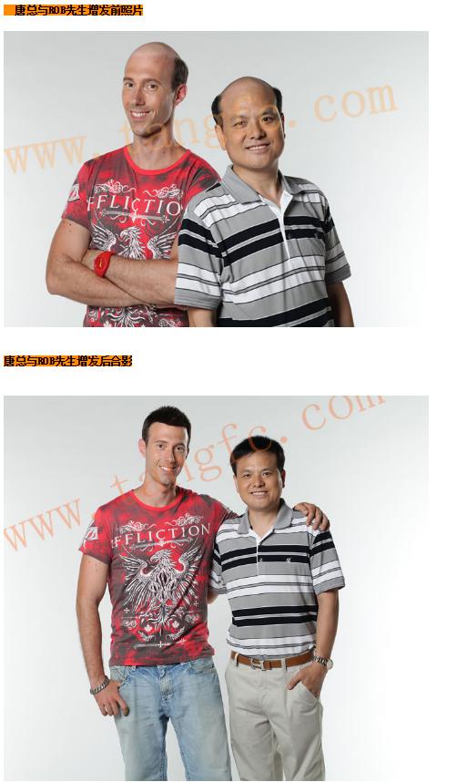 貝克漢姆的中年危機，脫發(fā)繞過誰？