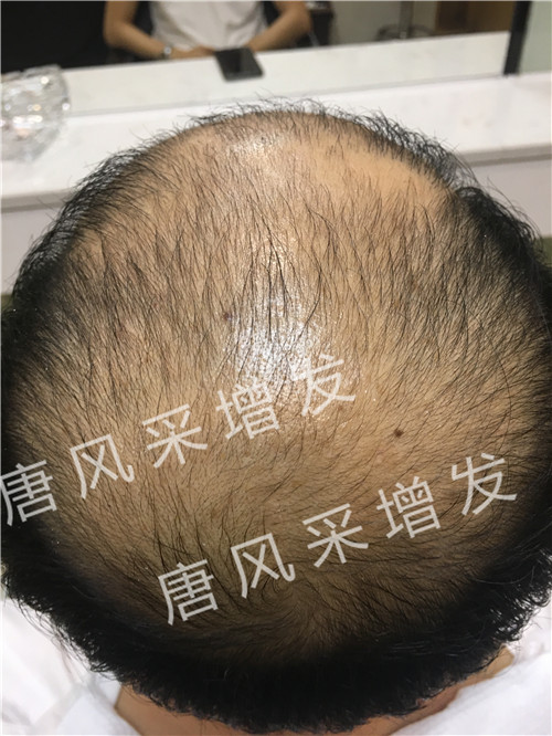 今天咱不看廣告宣傳了，唐風(fēng)采真實效果，上圖上視頻