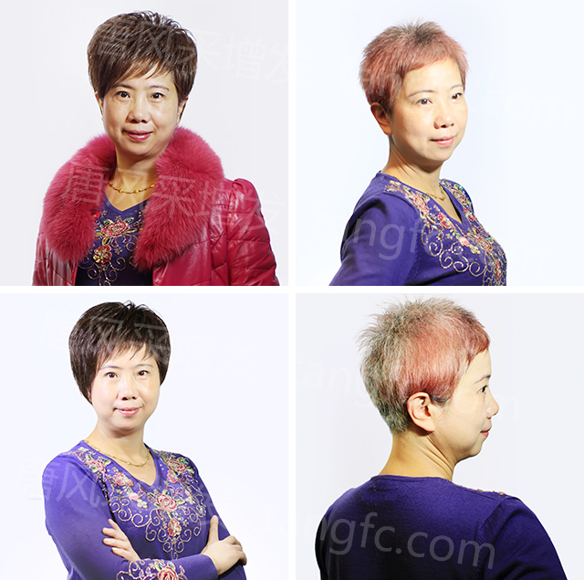 柳州織發(fā)假發(fā)訂做，效果杠杠不負(fù)好時光！