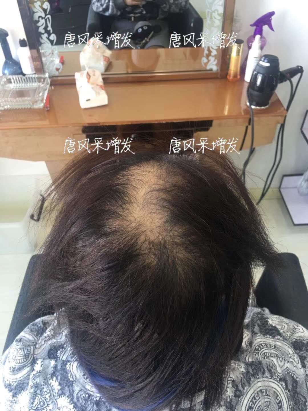  生發(fā)了這么久，但凡有效果的也該有些跡象了