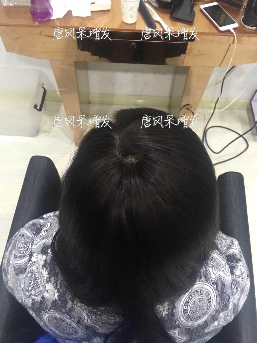 生發(fā)了這么久，但凡有效果的也該有些跡象了