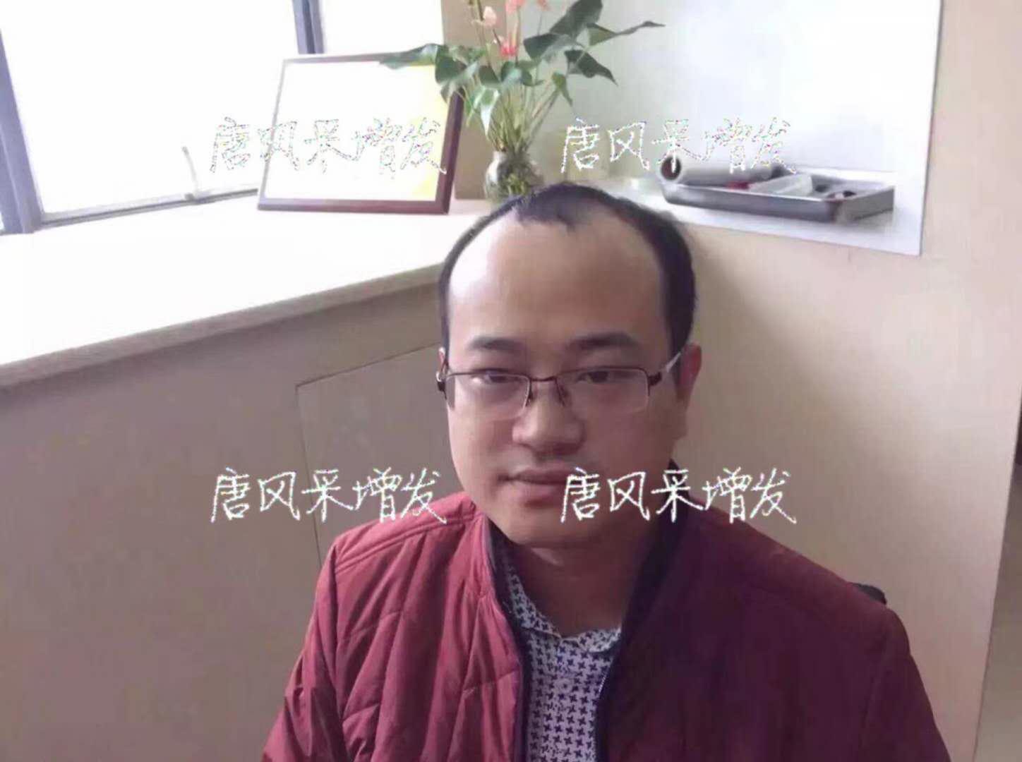  生發(fā)了這么久，但凡有效果的也該有些跡象了