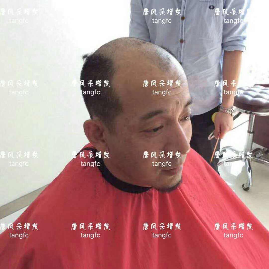  生發(fā)了這么久，但凡有效果的也該有些跡象了