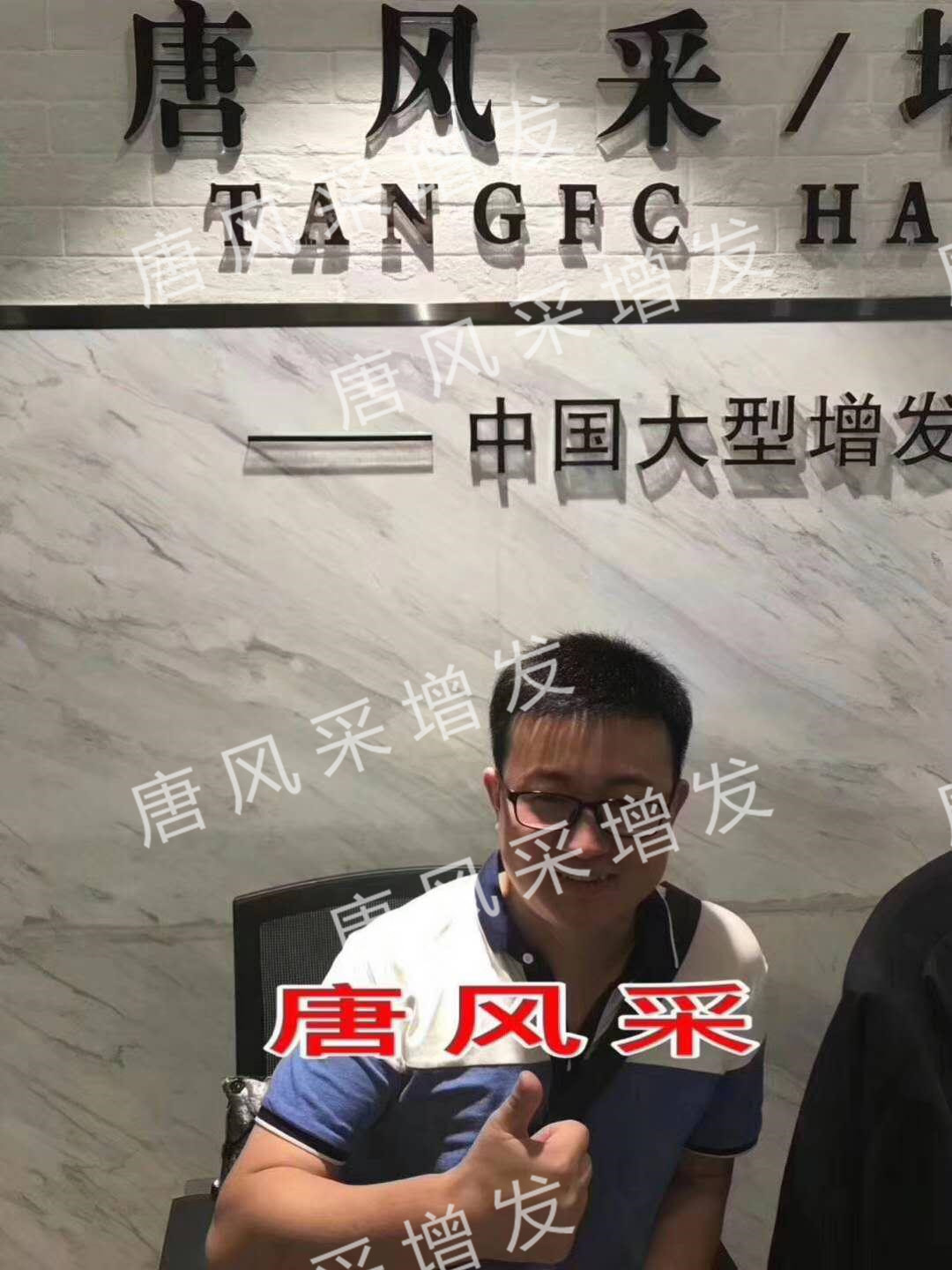 貧窮限制了想象，禿頂限制了造型？