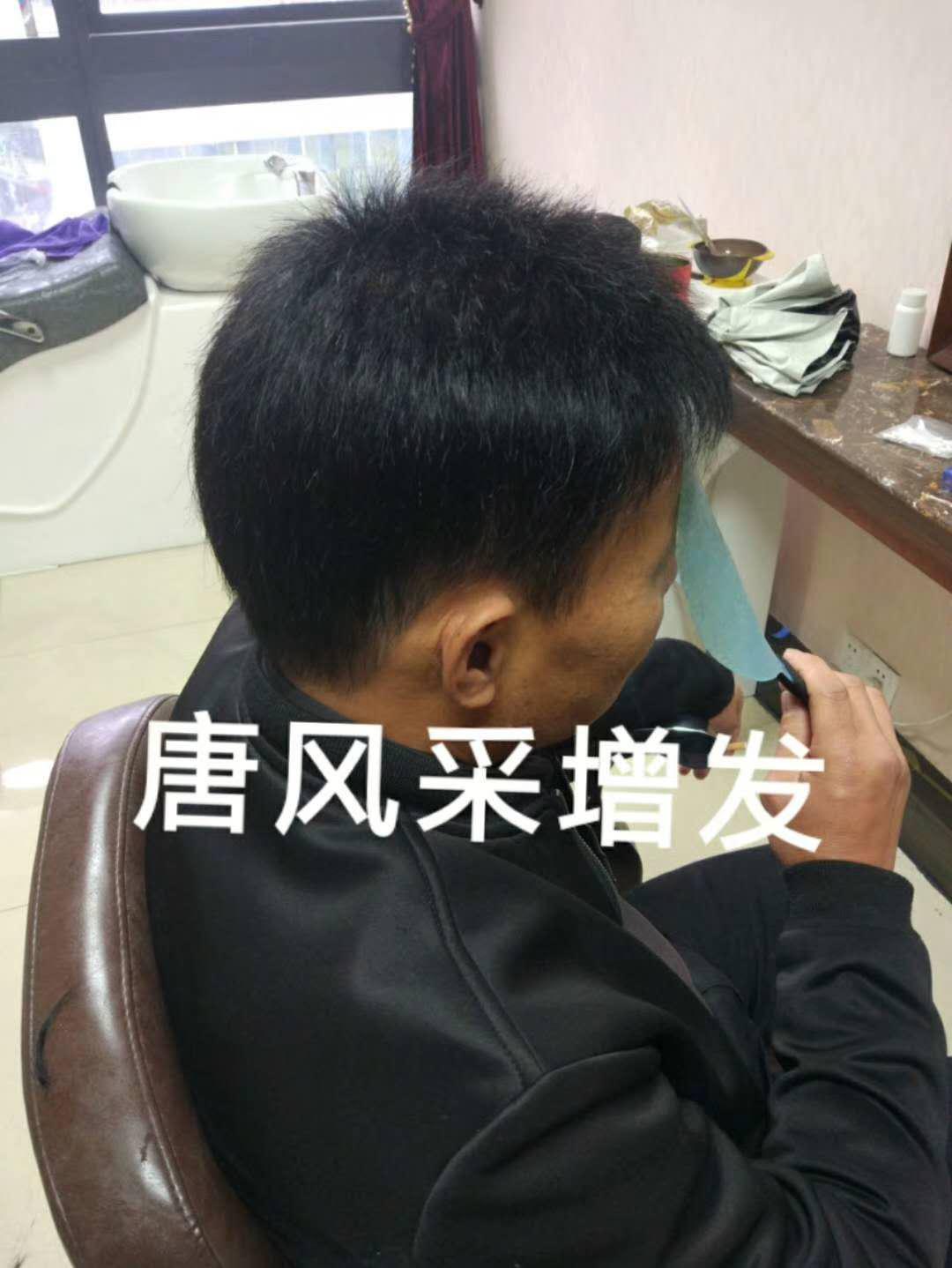 脫發(fā)謝頂壓力大，增發(fā)補發(fā)一身輕！