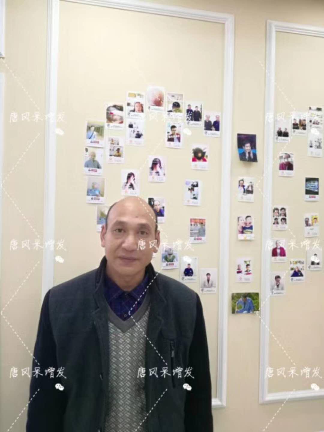 我的天吶！沒想到某防脫洗發(fā)水的老板居然也脫發(fā)了！