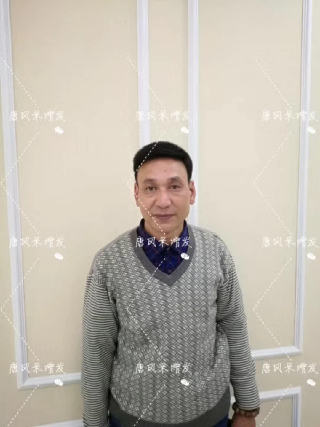 我的天吶！沒想到某防脫洗發(fā)水的老板居然也脫發(fā)了！