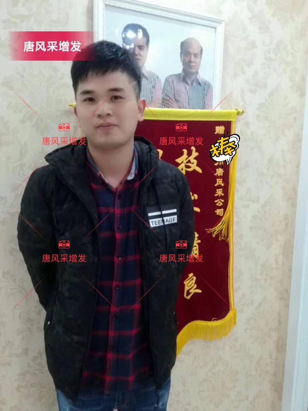 為脫發(fā)者解千愁，增發(fā)前后的驚人對比！