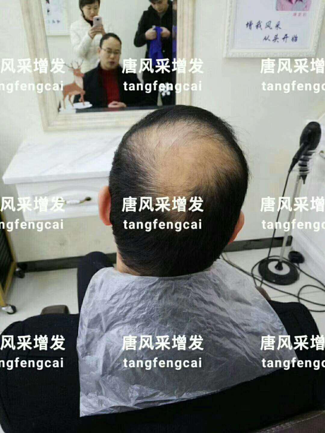  一轉(zhuǎn)眼年輕十歲，你差的就是這點(diǎn)點(diǎn)頭發(fā)！